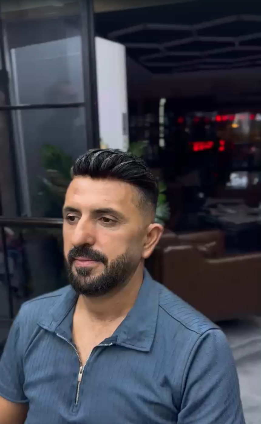 Protez Saç Merkezi
